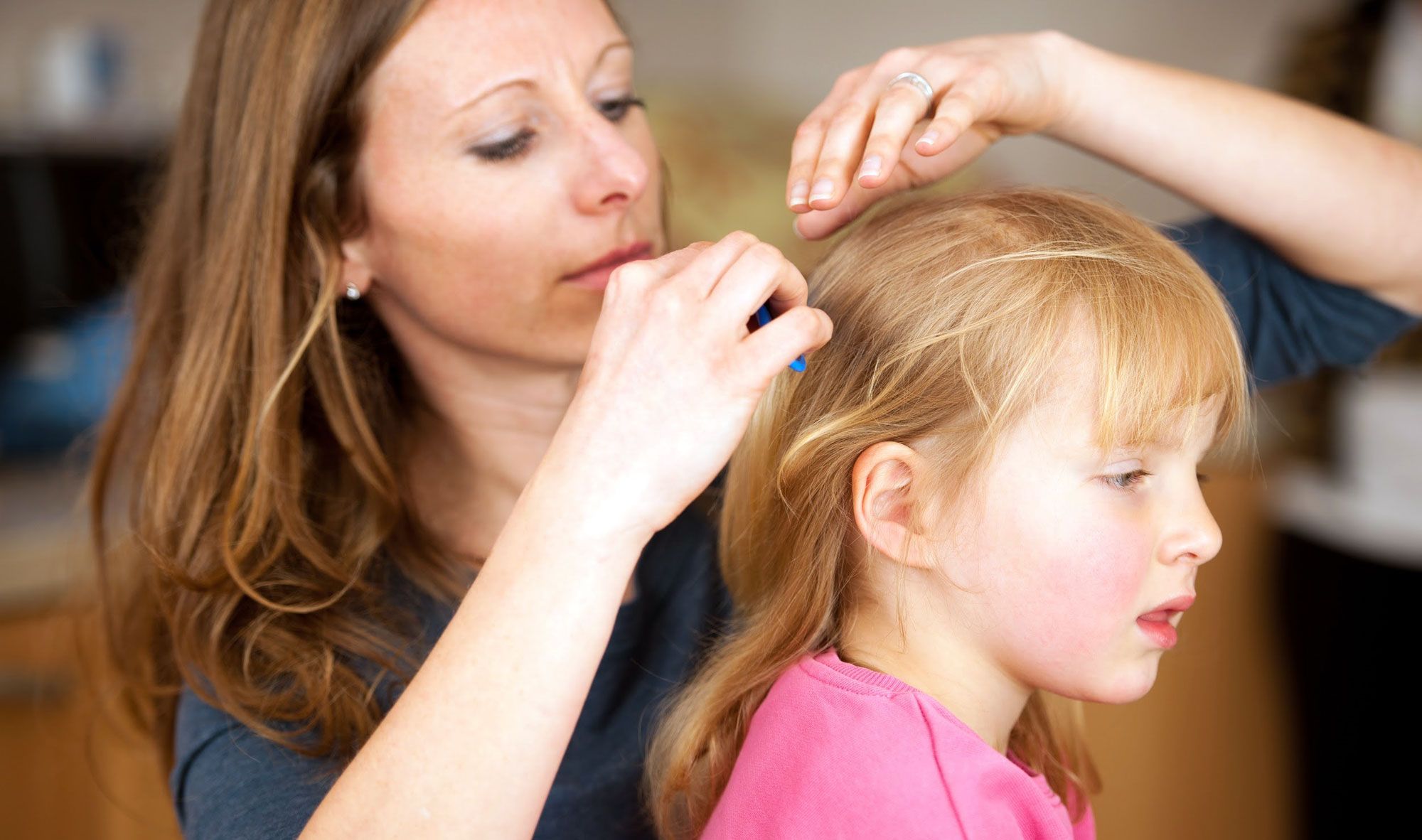 The Best Lice Treatments Of 2020 — ReviewThis